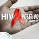 HIV positivo