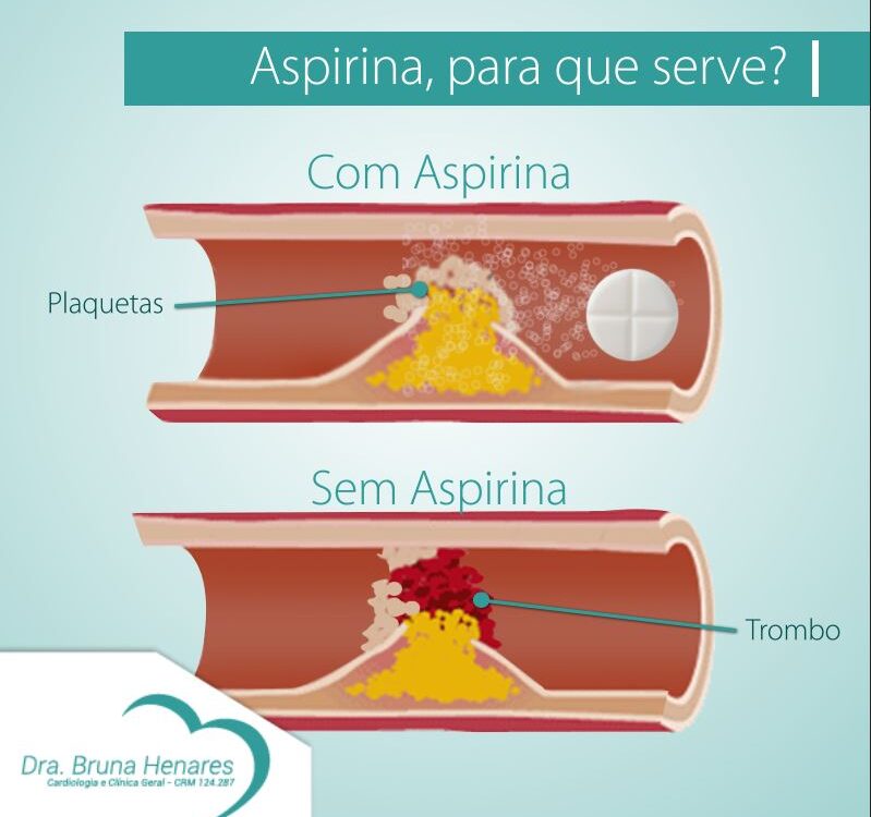 Aspirina para que serve