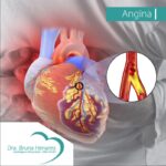 Angina