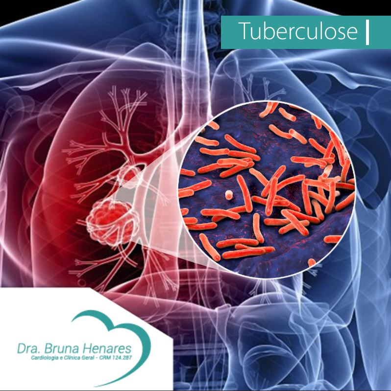 Tuberculose⁣⁣