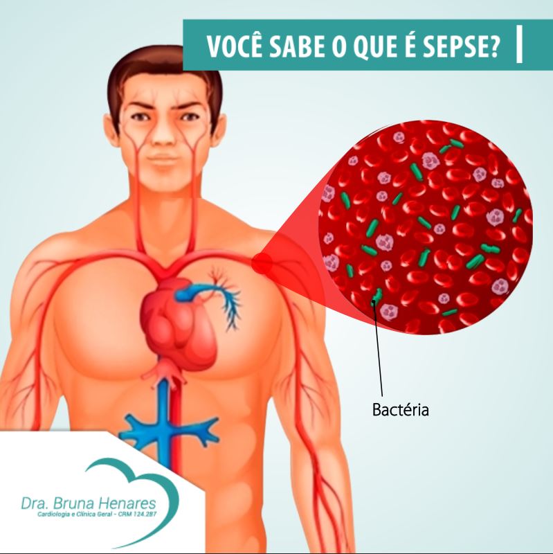 Você sabe o que é SEPSE? - Dra. Bruna Henares